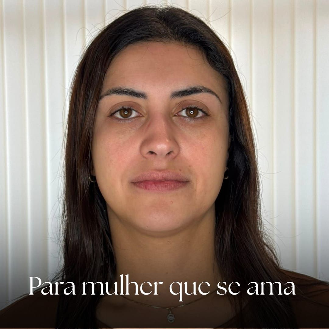A mesma paciente da imagem anterior, de frente, sem anotação, diante de um fundo claro de ripas verticais. Texto gravado na imagem: “Para mulher que se ama”.